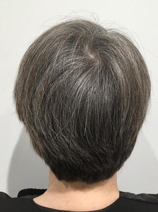 Foto de antes: vista trasera de una mujer con cabello negro corto con muchas canas antes de la coloración.